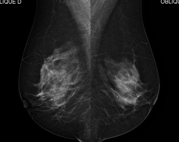 Echo Doppler - Coradix