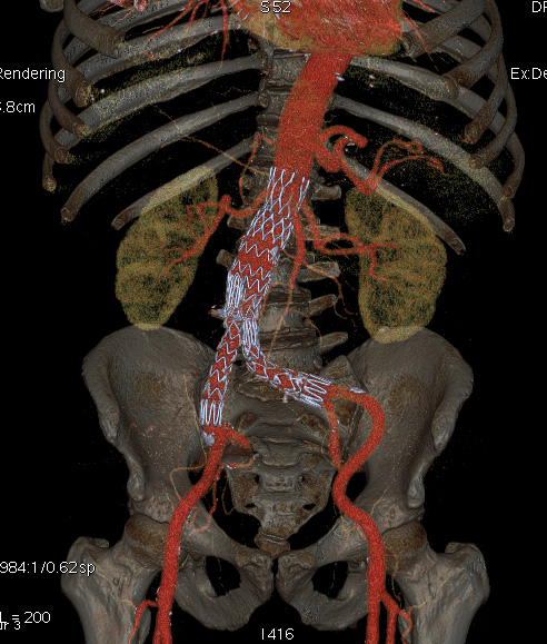 Scanner sans ou avec injection - Coradix