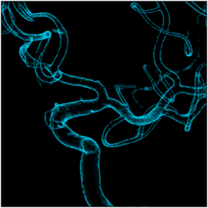 coro3d2-300x300