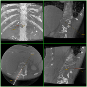 coro3d3-300x300
